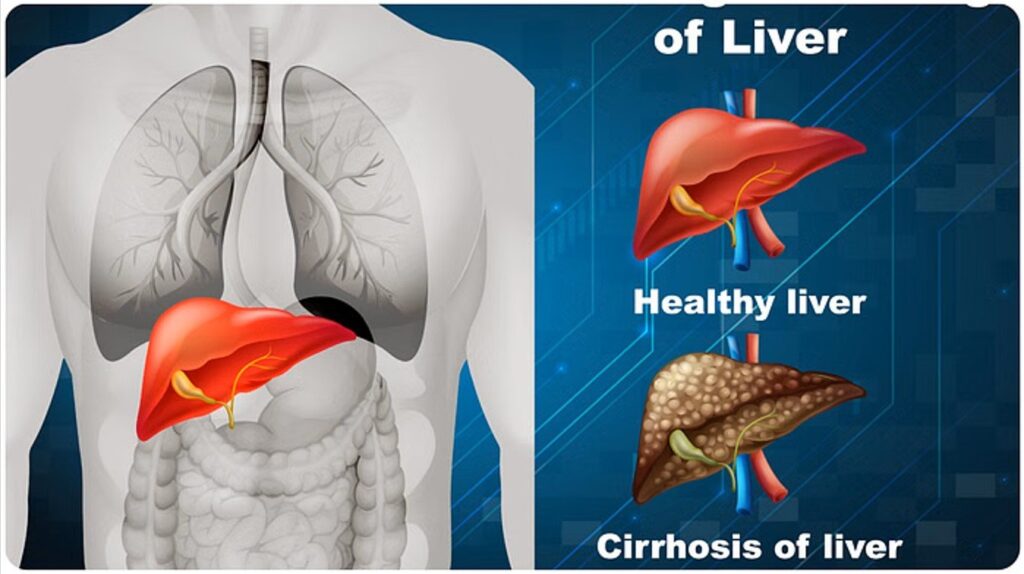 fatty liver symptoms prevention hindi